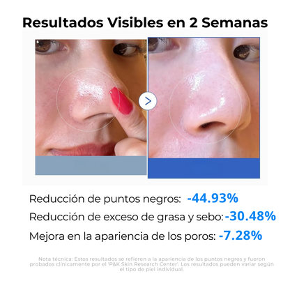 Almohadillas Doble Acción Cero Poros