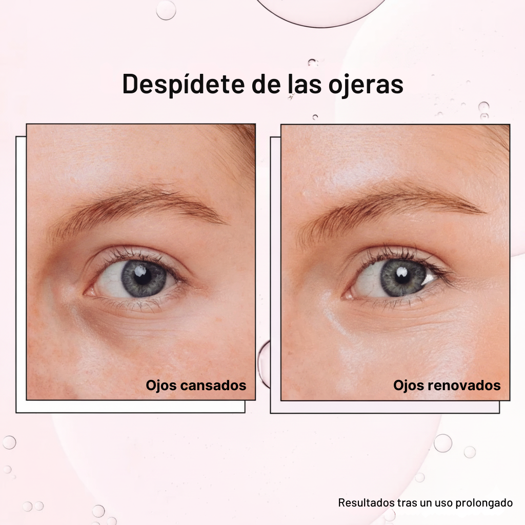 Roll-On Revitalizante para Ojos