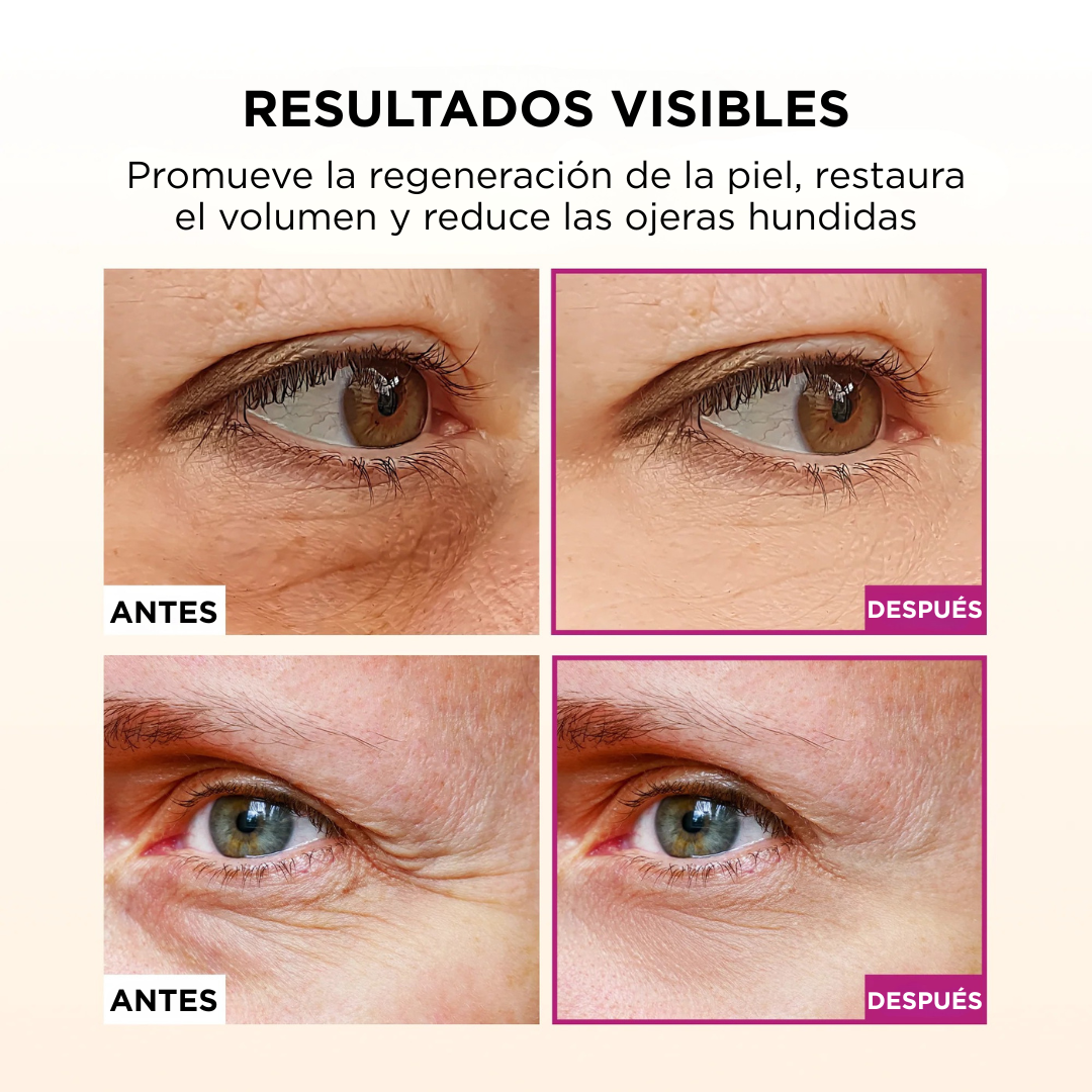 Bálsamo de Calcio Efecto Lifting